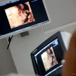 Ultraschallgeräte im Einsatz der Untersuchung in der Schwangerschaft